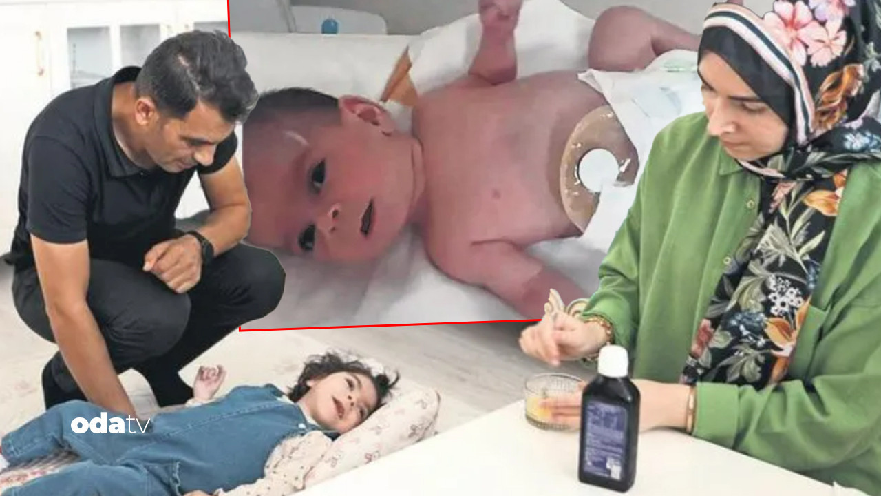 kuvozde dehset minik bebek omur boyu engelli kaldi 6eHXDnkZ.jpg